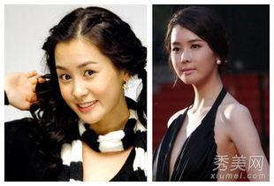 明星后期面部变化,揭秘面部变化背后的秘密